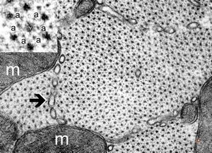  normal cardiomyocyte … transversal section (m … mitochondria, a … actin, my … myosin, arrow … tubules of s